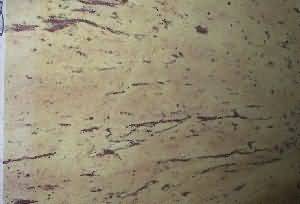 ����. Atlantic Ellou